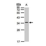 CACNG5 antibody from Signalway Antibody (22620) - Antibodies.com