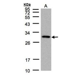 CTDSP2 antibody from Signalway Antibody (22750) - Antibodies.com
