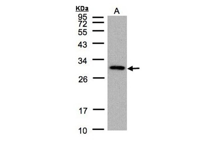 CTDSP2 antibody from Signalway Antibody (22750) - Antibodies.com