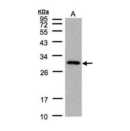 CTDSP2 antibody from Signalway Antibody (22750) - Antibodies.com