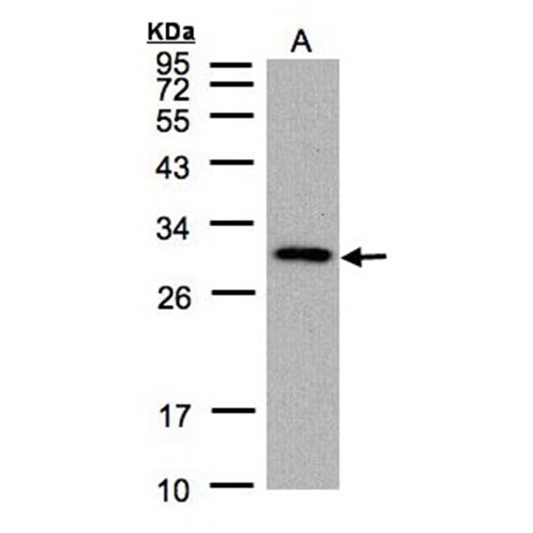 CTDSP2 antibody from Signalway Antibody (22750) - Antibodies.com