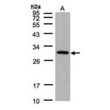 CTDSP2 antibody from Signalway Antibody (22750) - Antibodies.com