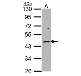 WNT10A antibody from Signalway Antibody (22752) - Antibodies.com