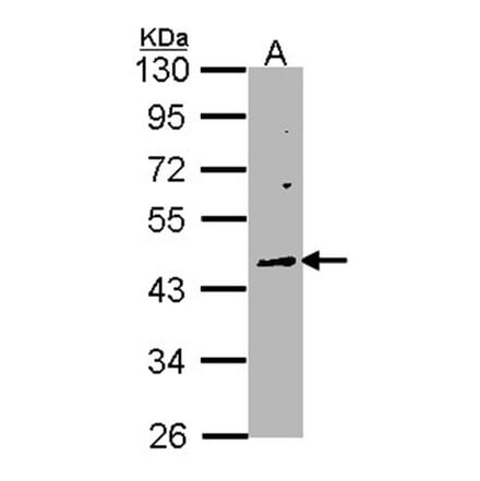 WNT10A antibody from Signalway Antibody (22752) - Antibodies.com