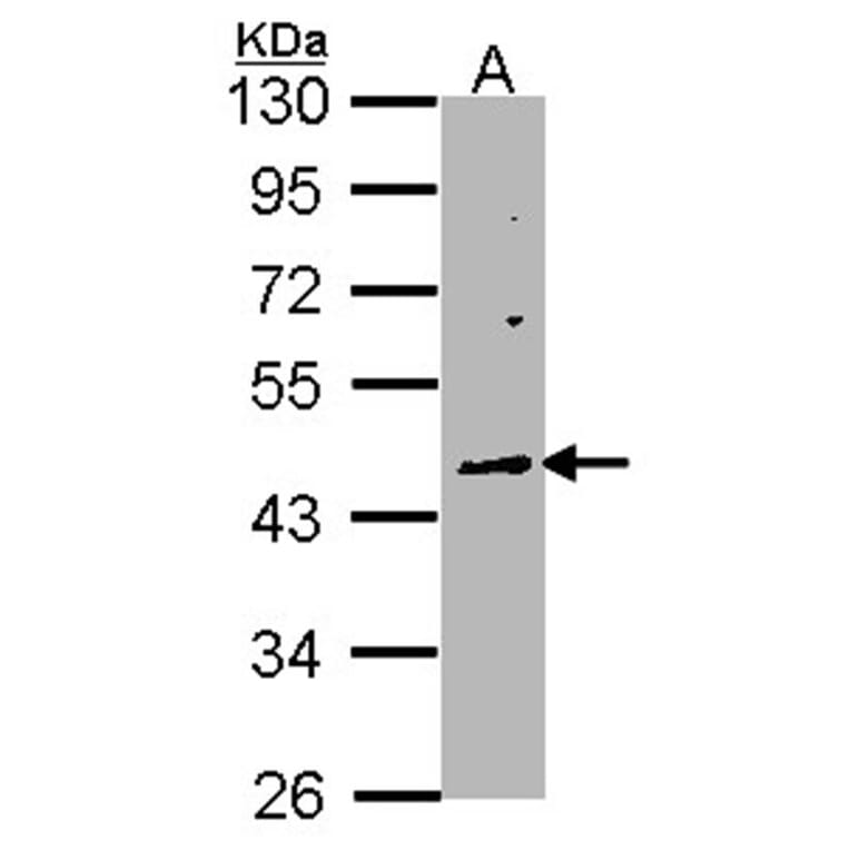 WNT10A antibody from Signalway Antibody (22752) - Antibodies.com