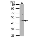 WNT10A antibody from Signalway Antibody (22752) - Antibodies.com