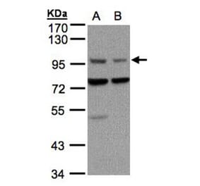 Axin 1 antibody from Signalway Antibody (22862) - Antibodies.com