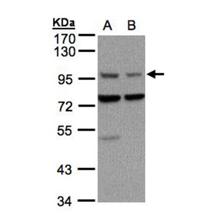 Axin 1 antibody from Signalway Antibody (22862) - Antibodies.com