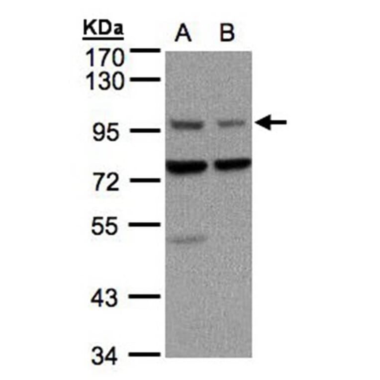 Axin 1 antibody from Signalway Antibody (22862) - Antibodies.com
