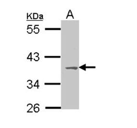 MC1-R antibody from Signalway Antibody (22911) - Antibodies.com