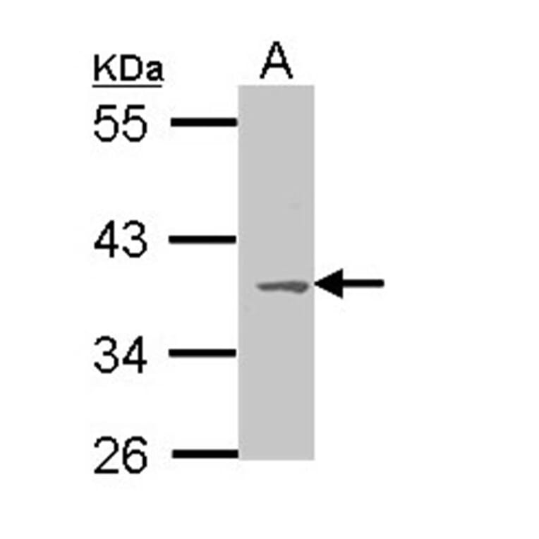 MC1-R antibody from Signalway Antibody (22911) - Antibodies.com