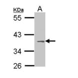 MC1-R antibody from Signalway Antibody (22911) - Antibodies.com