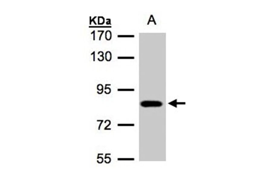 CLC-5 antibody from Signalway Antibody (22985) - Antibodies.com