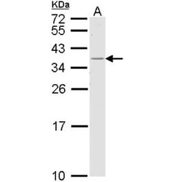 HLA-DR antibody from Signalway Antibody (23013) - Antibodies.com