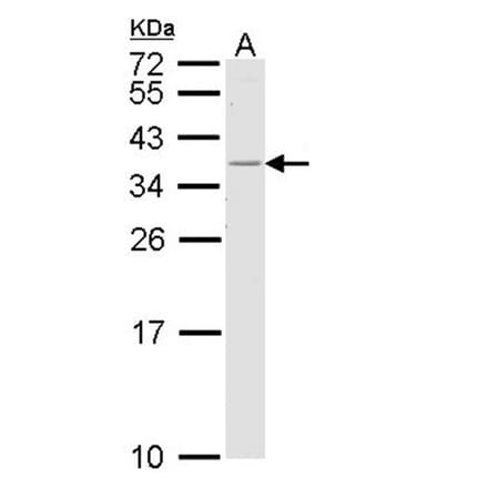 HLA-DR antibody from Signalway Antibody (23013) - Antibodies.com