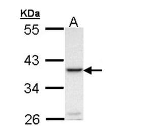 RANKL antibody from Signalway Antibody (23088) - Antibodies.com
