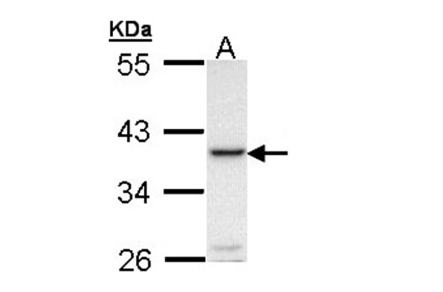 RANKL antibody from Signalway Antibody (23088) - Antibodies.com