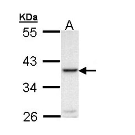RANKL antibody from Signalway Antibody (23088) - Antibodies.com