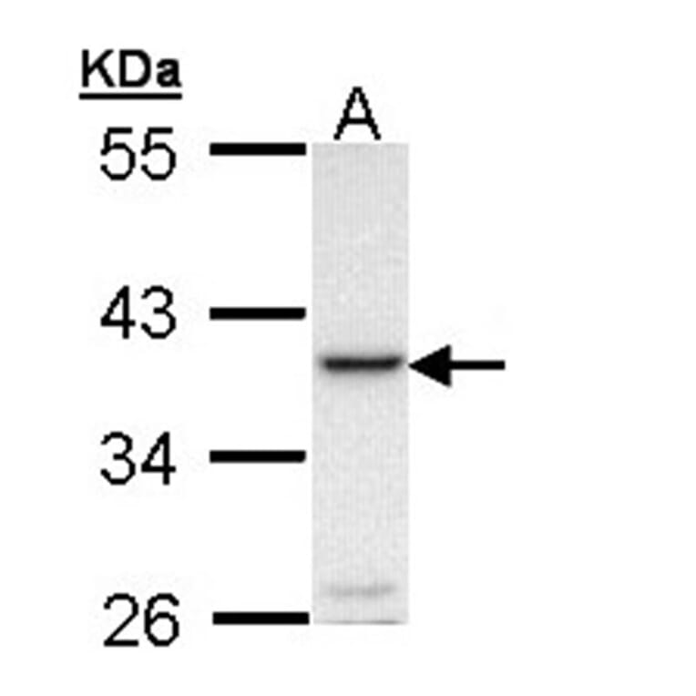 RANKL antibody from Signalway Antibody (23088) - Antibodies.com