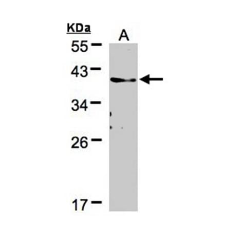 TMEM59 antibody from Signalway Antibody (23096) - Antibodies.com