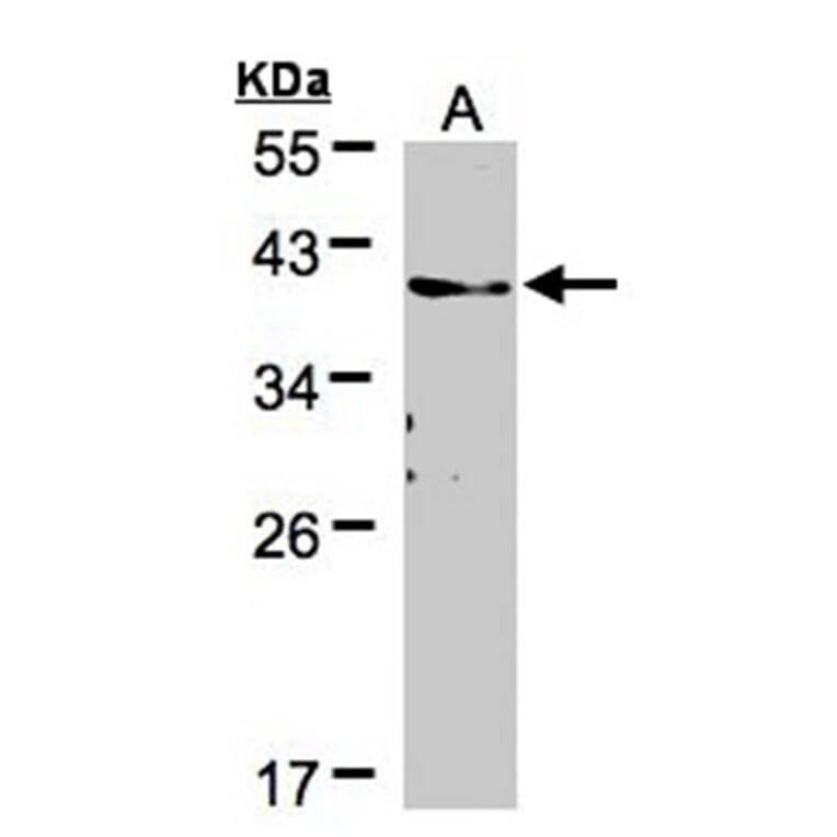 TMEM59 antibody from Signalway Antibody (23096) - Antibodies.com