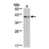 TMEM59 antibody from Signalway Antibody (23096) - Antibodies.com