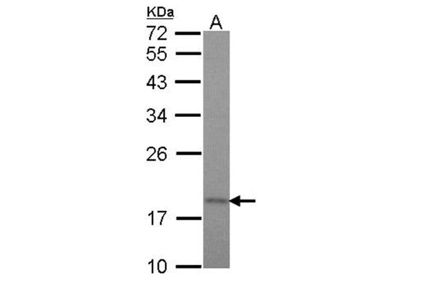 Tim17 antibody from Signalway Antibody (23106) - Antibodies.com