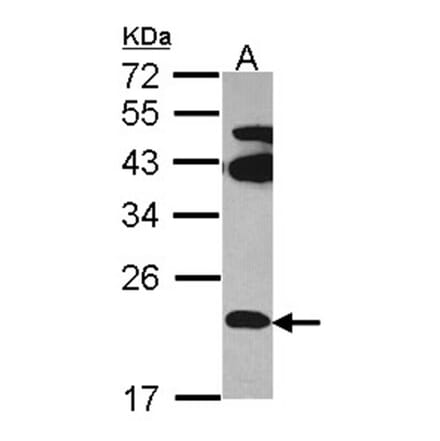 FAM18B antibody from Signalway Antibody (23127) - Antibodies.com