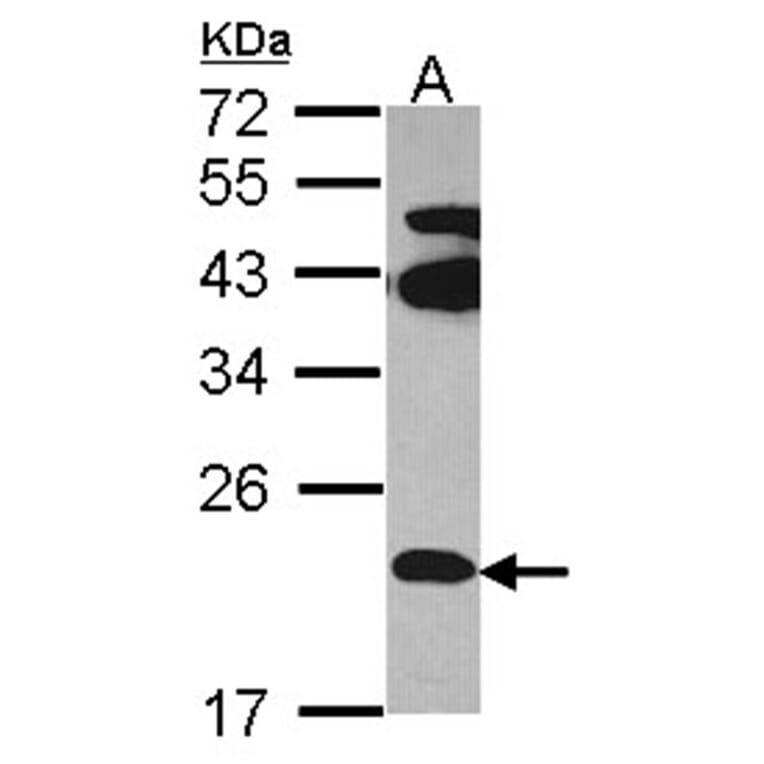 FAM18B antibody from Signalway Antibody (23127) - Antibodies.com