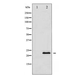 Western blot - TIMP1 Antibody from Signalway Antibody (29059) - Antibodies.com