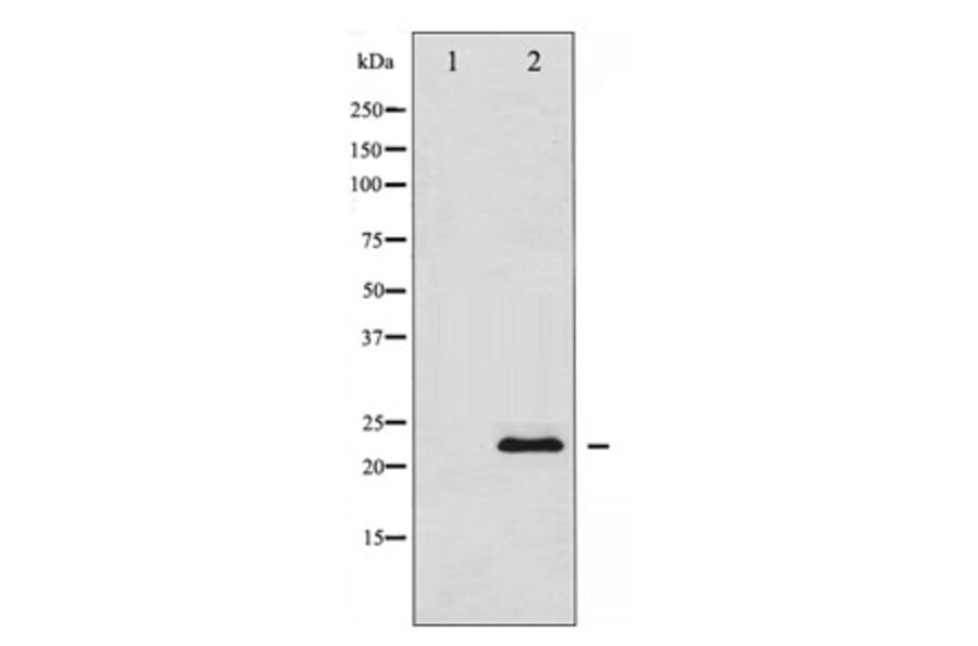 Western blot - TIMP1 Antibody from Signalway Antibody (29059) - Antibodies.com
