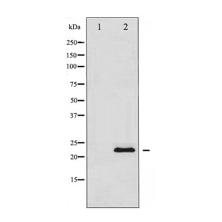 Western blot - TIMP1 Antibody from Signalway Antibody (29059) - Antibodies.com