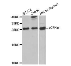 Western blot - CDKN1B Antibody from Signalway Antibody (32066) - Antibodies.com