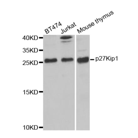 Western blot - CDKN1B Antibody from Signalway Antibody (32066) - Antibodies.com