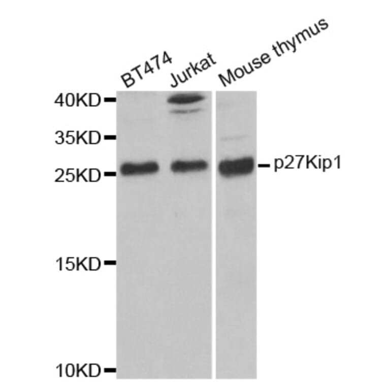 Western blot - CDKN1B Antibody from Signalway Antibody (32066) - Antibodies.com