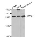 Western blot - CDKN1B Antibody from Signalway Antibody (32066) - Antibodies.com