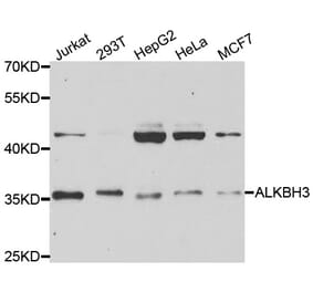 Western blot - ALKBH3 Antibody from Signalway Antibody (33056) - Antibodies.com