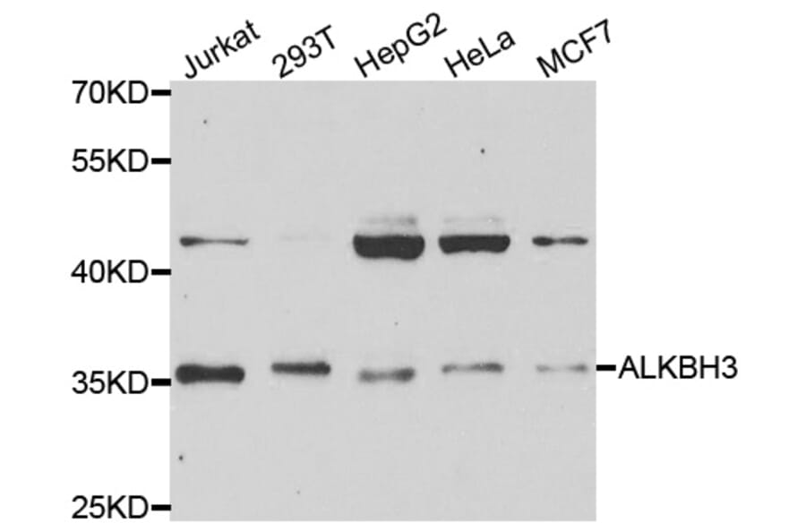 Western blot - ALKBH3 Antibody from Signalway Antibody (33056) - Antibodies.com