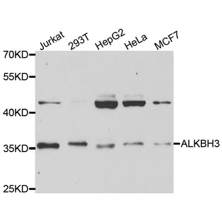 Western blot - ALKBH3 Antibody from Signalway Antibody (33056) - Antibodies.com