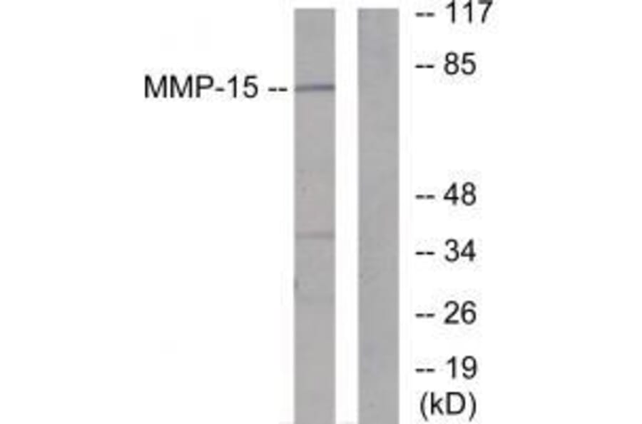 Western blot - MMP-15 Antibody from Signalway Antibody (33438) - Antibodies.com