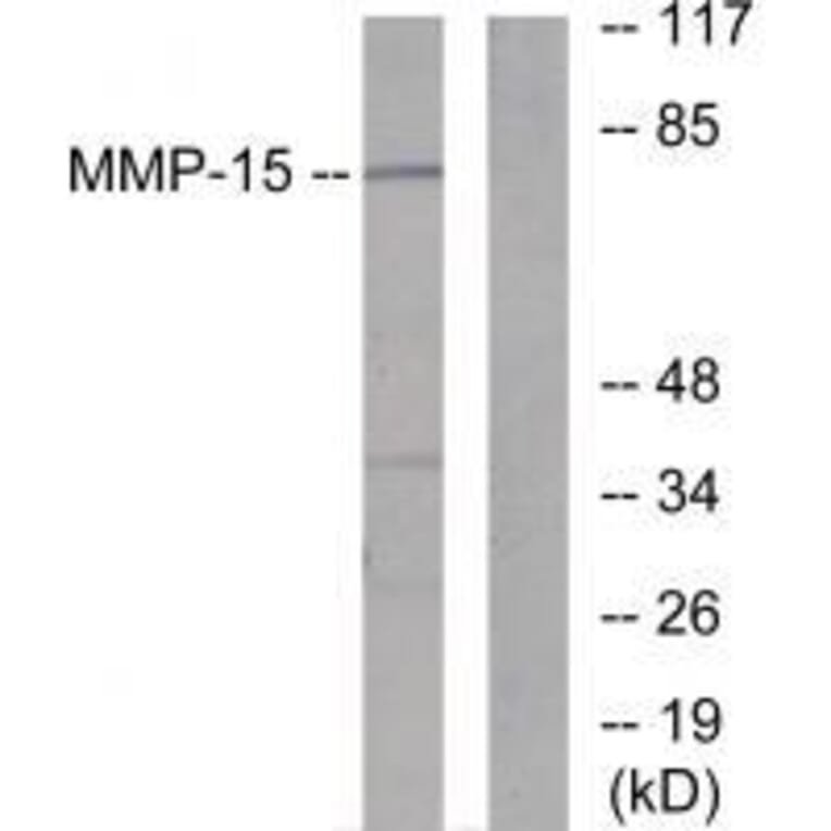 Western blot - MMP-15 Antibody from Signalway Antibody (33438) - Antibodies.com