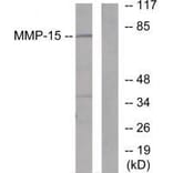 Western blot - MMP-15 Antibody from Signalway Antibody (33438) - Antibodies.com