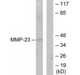 Western blot - MMP-23 Antibody from Signalway Antibody (33442) - Antibodies.com