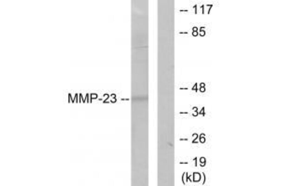 Western blot - MMP-23 Antibody from Signalway Antibody (33442) - Antibodies.com