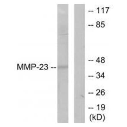 Western blot - MMP-23 Antibody from Signalway Antibody (33442) - Antibodies.com
