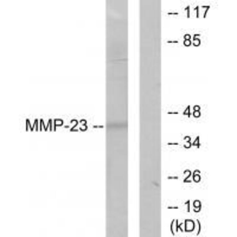 Western blot - MMP-23 Antibody from Signalway Antibody (33442) - Antibodies.com