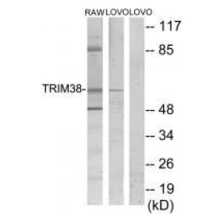 Western blot - TRIM38 Antibody from Signalway Antibody (33562) - Antibodies.com