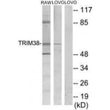 Western blot - TRIM38 Antibody from Signalway Antibody (33562) - Antibodies.com