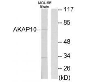 Western blot - AKAP10 Antibody from Signalway Antibody (33587) - Antibodies.com