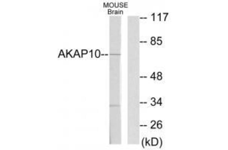 Western blot - AKAP10 Antibody from Signalway Antibody (33587) - Antibodies.com